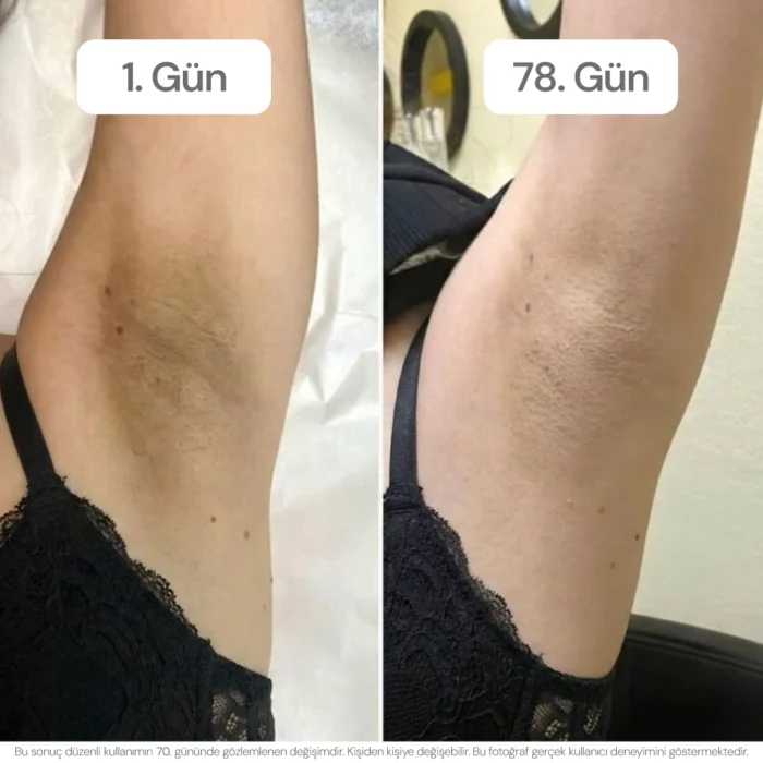 vagenmax-before-after