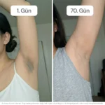 vagenmax-before-after