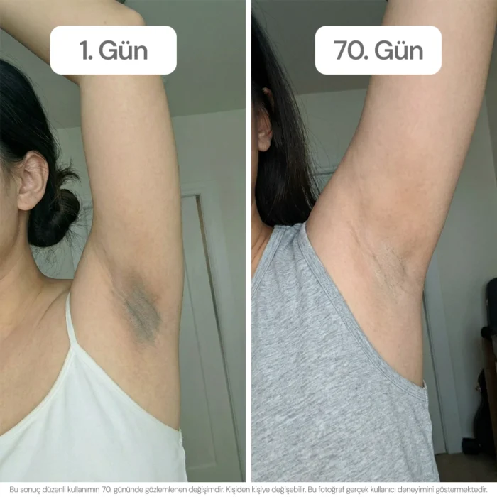 vagenmax-before-after
