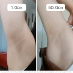 veganmax before after
